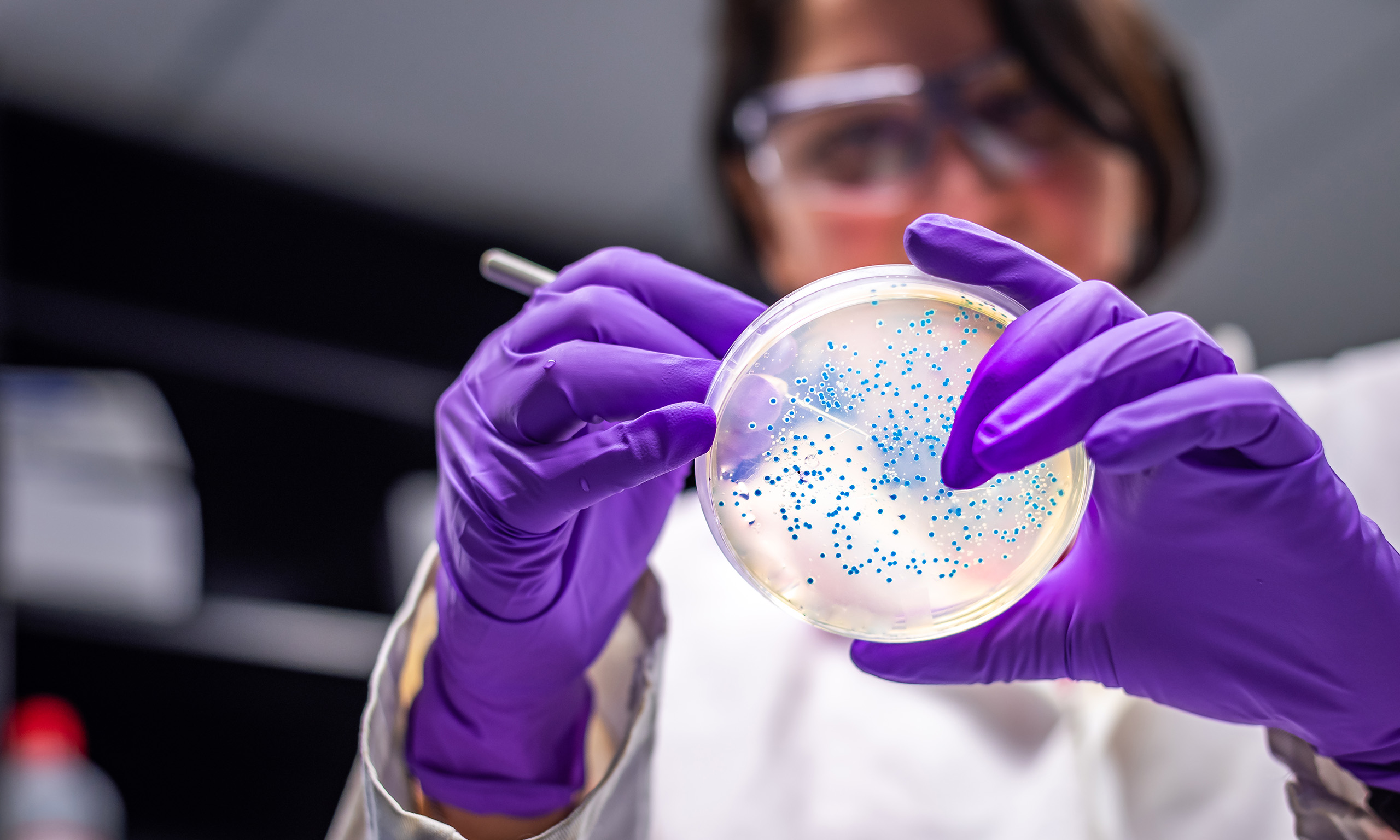 Picture of scientist performing examination of bacterial culture plate representing Sagentia Regulatory's Antimicrobial Registration Services