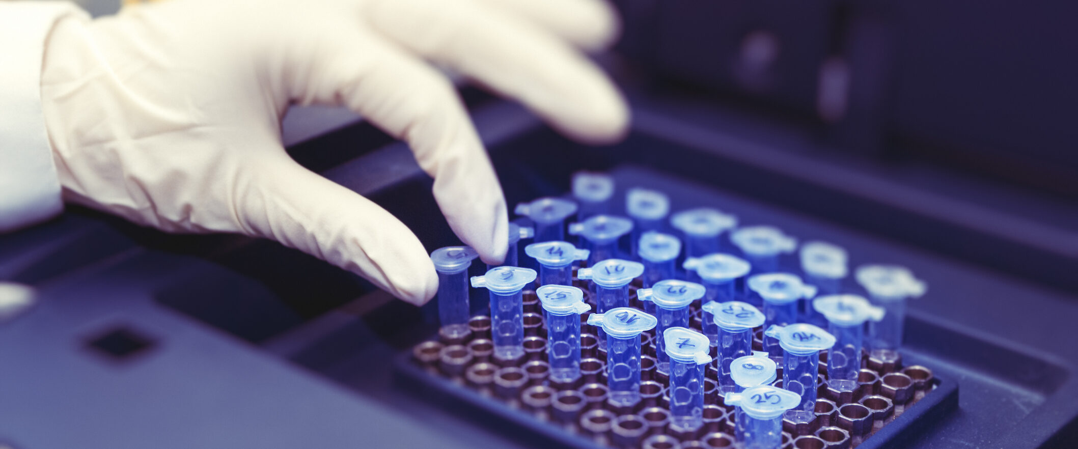 Gloved hand placing a blue-topped microcentrifuge tube into a rack in a laboratory.