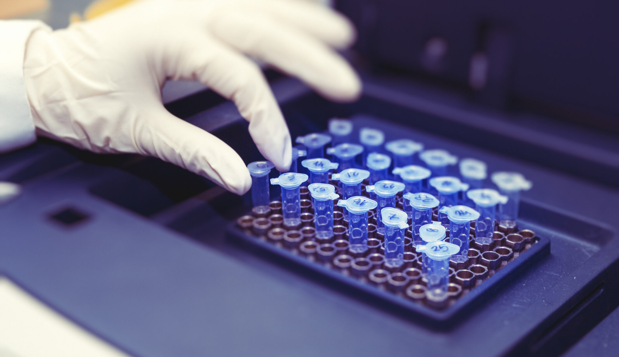 Gloved hand picking up a small blue-lidded test tube from a rack in a lab.